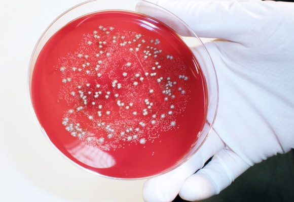 Microbiota intestinal humana: funciones metabólicas, defensivas y tróficas