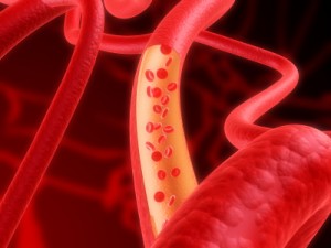 Probióticos y riesgo cardiovascular