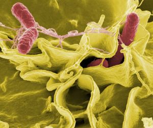 Aproximación de los clínicos a la ecología bacteriana