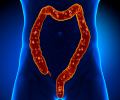 Colon Anatomy - pain