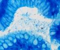 helicobacter