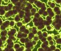 bacteria